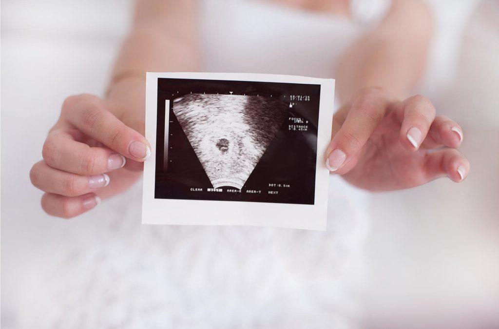 Pierwsza wizyta w ciąży u ginekologa- dostępne terminy