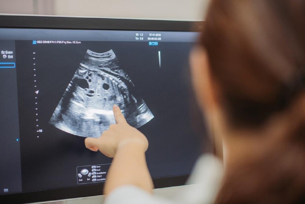 Dlaczego pierwsza wizyta u ginekologa na początku ciąży jest tak ważna?